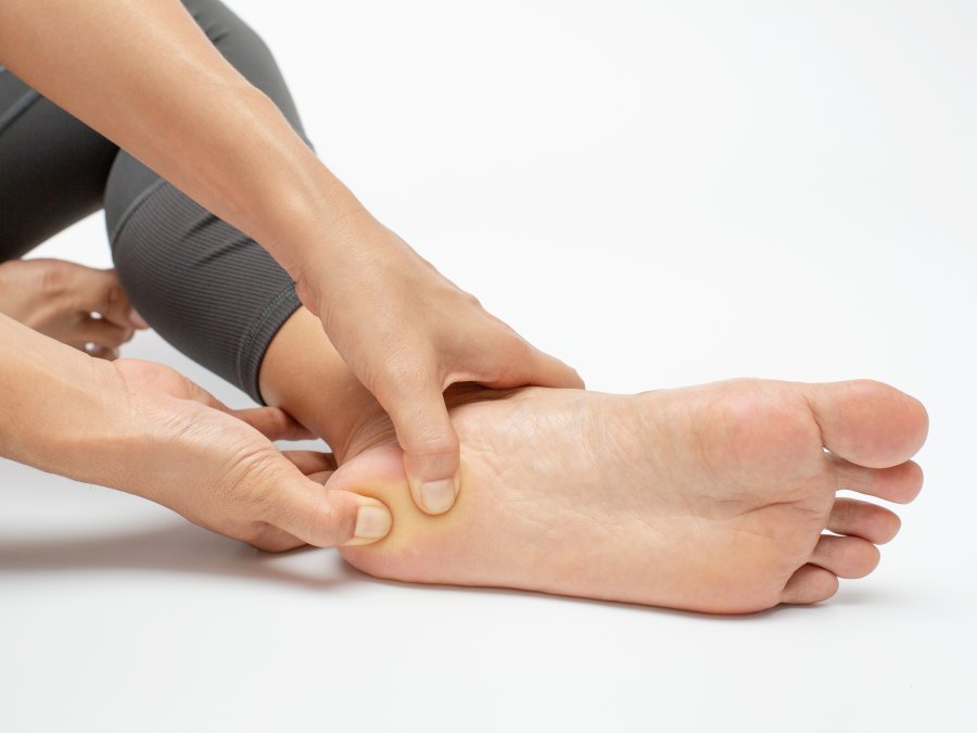 Plantar Fasciitis Embolization